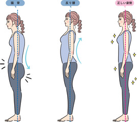 猫背と反り腰と正しい姿勢のセット