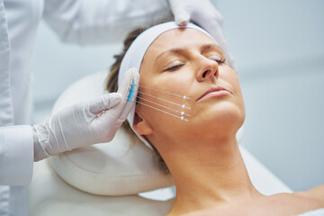 A scene of medical cosmetology treatments botulinum injection.