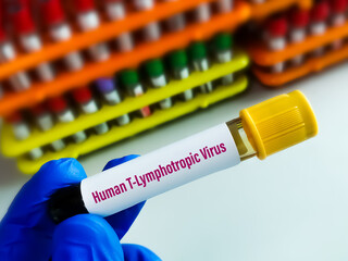 Blood sample for Human T-lymphotropic virus or Human T-cell leukaemia virus or HLTV test, to...
