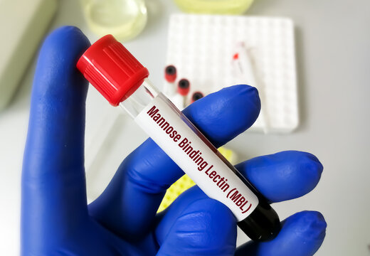 Blood sample for Mannose binding lectin or Mannan binding lectin test