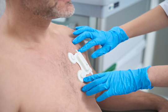 Paramedic glues electrode to chest of patient with naked torso