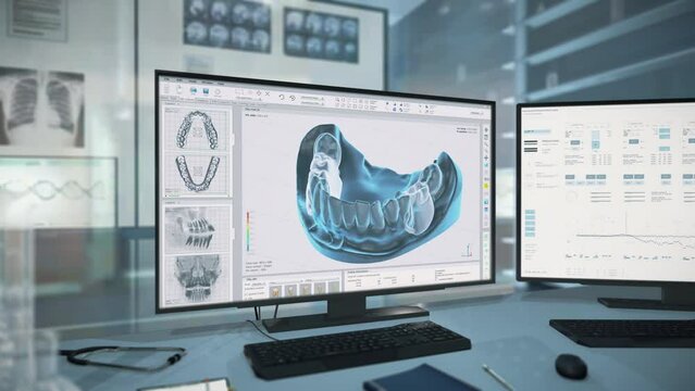 Dental clinic program interface displaying the insertion of teeth into the jaw. Displaying the digital dental clinic surgery projection. Dental clinic software displaying the jaw healing. Stomatology.