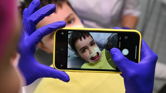 Top view dentist's hands hold modern smartphone in live view mode, filming the result of professional teeth cleaning and polishing performed to a teen boy with retractor in mouth. Pediatric dentistry