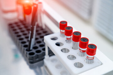 Biochemistry analyzing ward. Hospital laboratory for analysing blood samples.