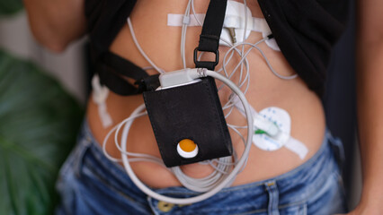 Woman with Holter monitor for daily monitoring of electrocardiogram and blood pressure.