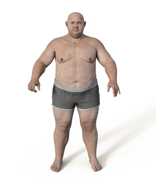 Obese man, 3D illustration. Concept of obesity