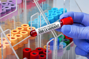 Hand with blood sample labeled with New Variant Omicron XBB of the Sars-cov-2 or Coronavirus Covid....