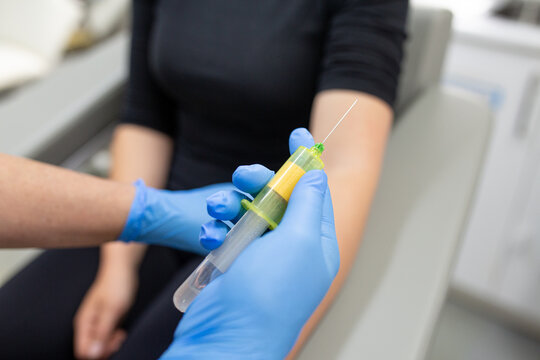 Close-up of nurse's hands taking blood from a patient