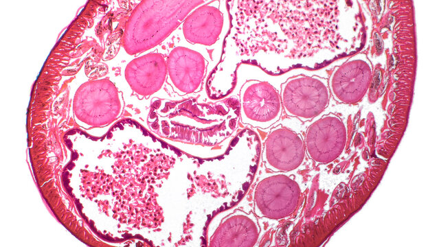 Ascaris lumbricoides under microscope. Haematoxylin end eosin stain.