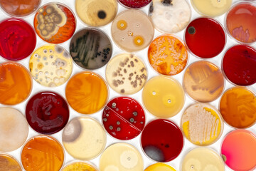 photo of collection of plastic plates containing culture media with growth of microorganisms