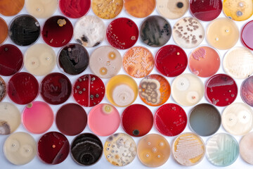 plates containing culture media with growth of microorganisms