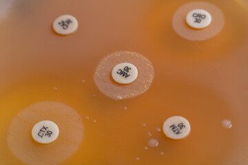 plates containing culture media with growth of microorganisms