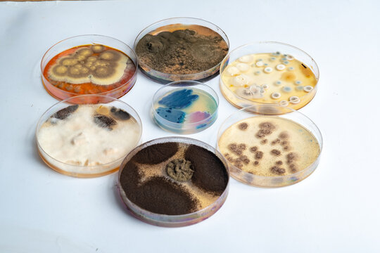 photo of bacteria and fungi growth on culture media in plastic plates