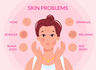Types skin problems. Woman face with skins troubles, melasma pimple blemishes acne teenager problem blackhead cosmetic wrinkle spot scar facial redness, swanky vector illustration