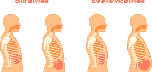 Diaphragmatic breathing. Pulmonary exercises chest and abdominal breath training, relax trachea respiration technique, inhale exhale medical infographic poster vector illustration - obrazy, fototapety, plakaty