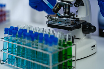 Doctor holding test tube with blue liquid, laboratory analysis for microscopic test in hospital laboratory