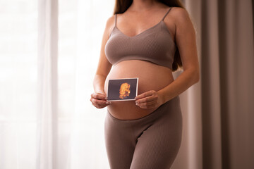 Unrecognizable caucasian pregnant woman holding 3d ultrasound sonogram,photo on baby bump,belly near window, cropped shot,Pastel colours.Natural,healthy,beautiful pregnancy concept.Copyspace for text.
