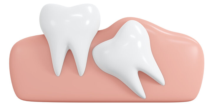 3D Rendering angular wisdom teeth icon cartoon style isolated on white. 3D Render illustration.