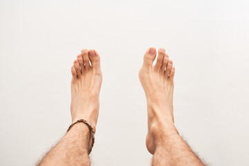 Feet of person with bunion, medical condition of deformation of the bones