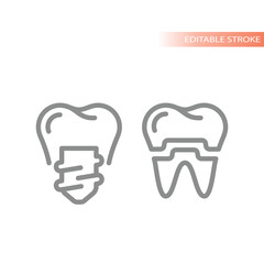 Dental implant and crown line vector icon. Tooth implantology outline symbol.