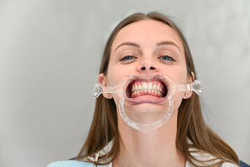 The doctor removes the patient's braces at the dental clinic. People, medicine, dentistry and healthcare concept.	