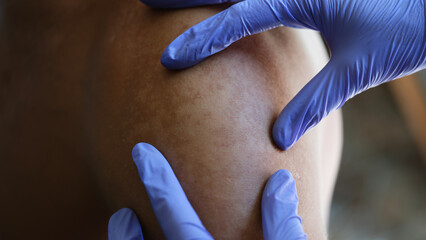 Dermatologist checking skin pigmentation of patient skin in hospital.