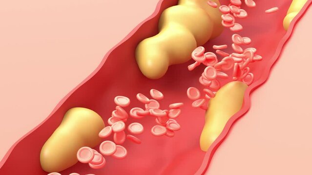 cholesterol and red blood cells 3d representation, blood flow animation that can represent the circulatory system. can be used to represent unhealthy eating, medical science or a heart attack