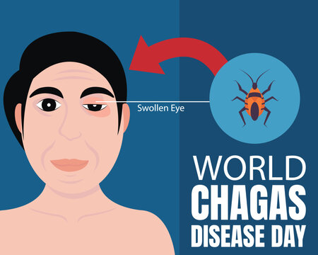 illustration vector graphic of a man has been bitten by a kissing bug on his eyelid, perfect for international day, world chagas disease day, celebrate, greeting card, etc.