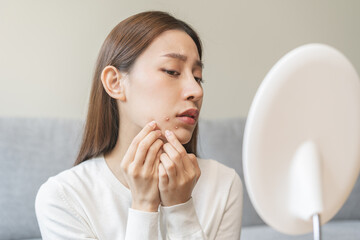Expression worry asian young woman hand touching pustule around the chin and mouth, allergic when wear mask, makeup, show squeezing pimple spot from face. Beauty care, skin problem by acne treatment. - obrazy, fototapety, plakaty