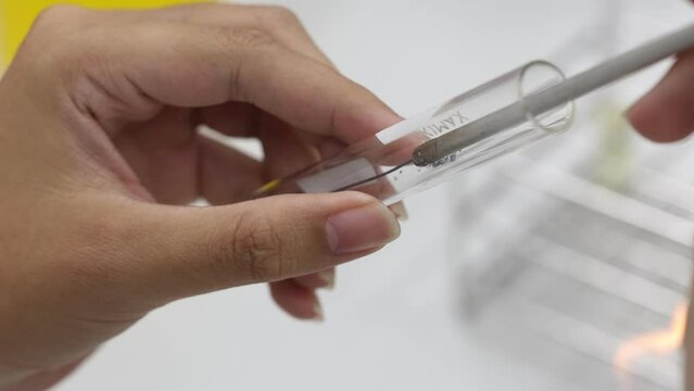 Cultivation of microorganisms on agar medium plate in microbiology laboratory and aseptic technique.