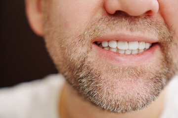 Obraz premium close-up. the man's mouth with stubble smiles and shows white teeth. the concept of dental services, whitening and veneers.