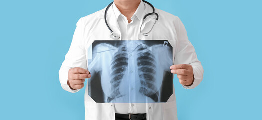 Senior doctor with x-ray image of lungs on light blue background