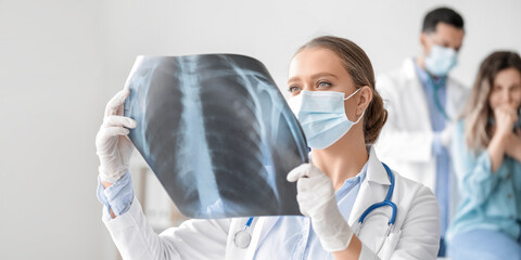 Female doctor with x-ray image of lungs in clinic