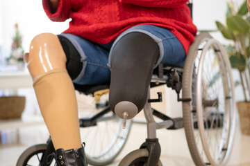 Detail of the socket of a leg prosthesis of a disabled woman.