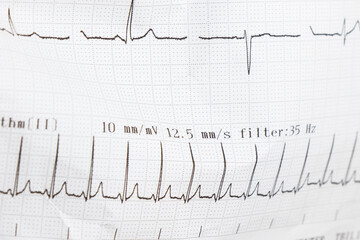 Cardiogram, waves of heart beat, EKG on the paper