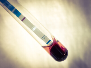 HBsAg Test Medical check up test, with whole blood sample and testing kit in glass test tube