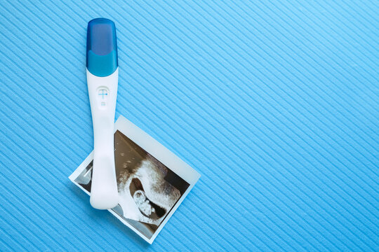 Positive pregnancy test with two strips with ultrasound picture of the embryo. Blue color background. Positive result. Without nobody