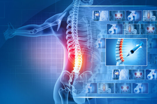 pain in the spine, pain in the back, lumbar spine injection, highlighted in red, x-ray view. 3d illustration