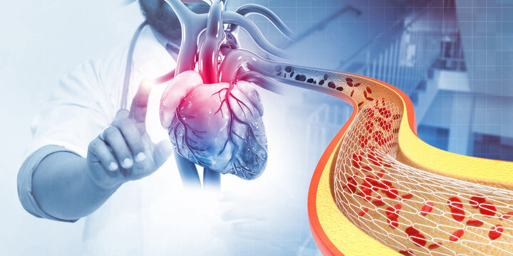 Doctor check and diagnose the heart health, stent angioplasty. 3d illustration