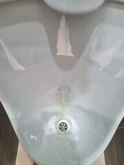 a stream of urine in a bidet. the concept of men's health. urologist services. urological problems...