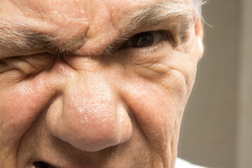 Close up of an older man with one eye closed squinting