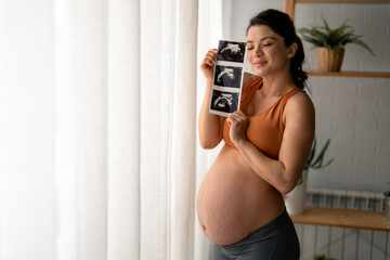 Cute future mother holding ultrasound baby images in her hands and also showing her pregnant belly...