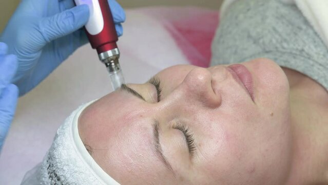Shot of beautician doing dermapen mesotherapy injection on face for rejuvenation in spa, 4k video.