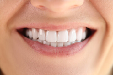 Close-up of healthy smooth white teeth smile.