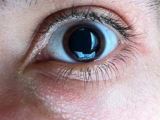 Close-up of a man's brown eye with dilated big pupil. Eye drops after a visit to an...