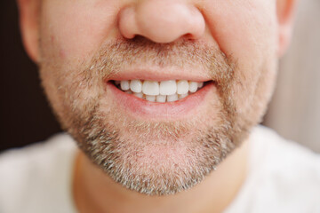 Fototapeta premium close-up. the man's mouth with stubble smiles and shows white teeth. the concept of dental services, whitening and veneers.