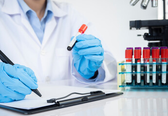 Doctor hand taking a blood sample tube from a rack with machines of analysis in the lab background.