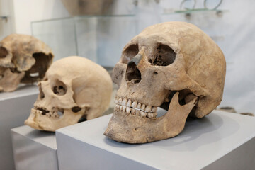 Skull of an old man close up. Anatomical mummified part of the human body. Sample for study.
