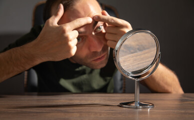  Man trying squeeze acne on face.