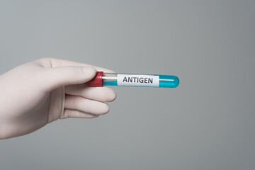 Obraz premium Cropped view of doctor in latex glove holding test tube with antigen lettering isolated on grey.